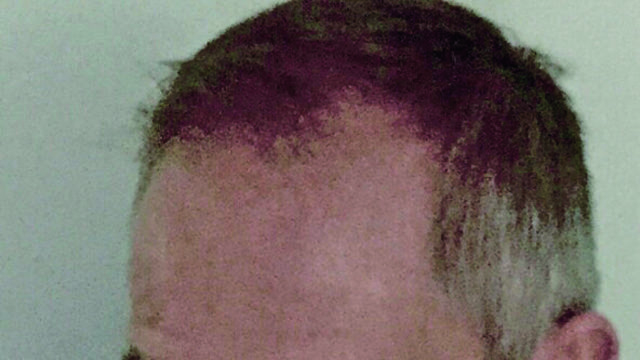 B Fox_edited-1